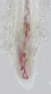 Resistant tomato root tip infected with second-stage juveniles of root-knot nematode, stained pink with acid fuchsin. Dark stained areas indicate dead cells (HR).